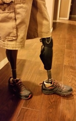 2015-10-28 20.25.05 Million Dollar Legs